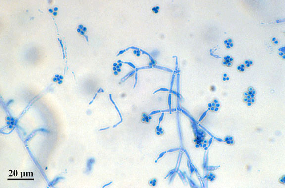 trichoderma